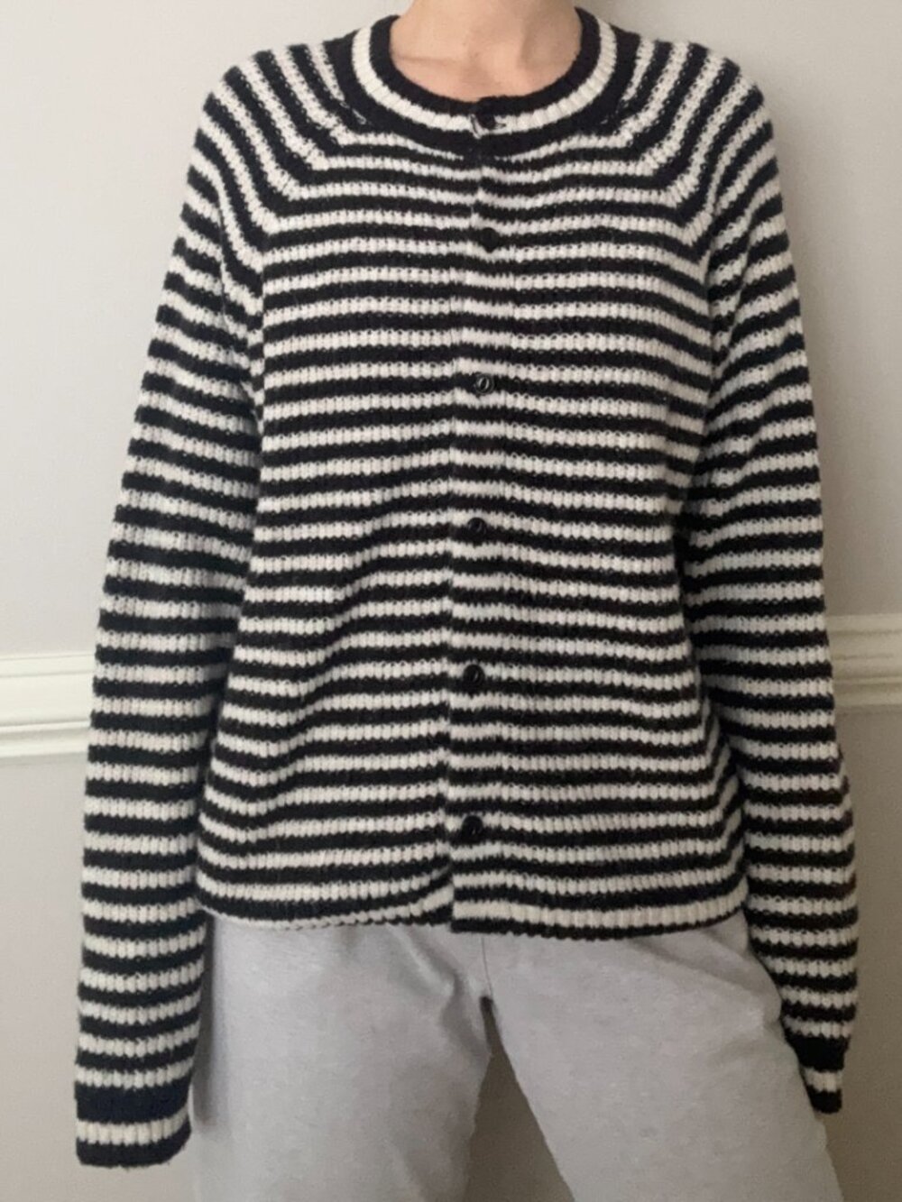 ASOS Design Striped Black and White Knit Cardigan